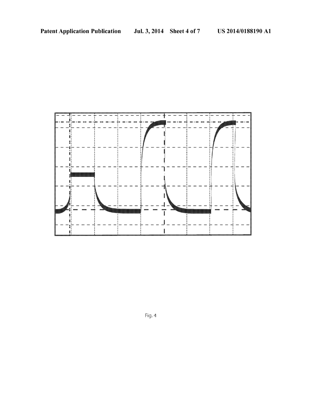 TRANSCUTANEOUS ELECTRICAL STIMULATION WAVEFORM GENERATOR AND METHOD OF USE - diagram, schematic, and image 05