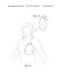 Lactation Aid And Soothing Garment diagram and image