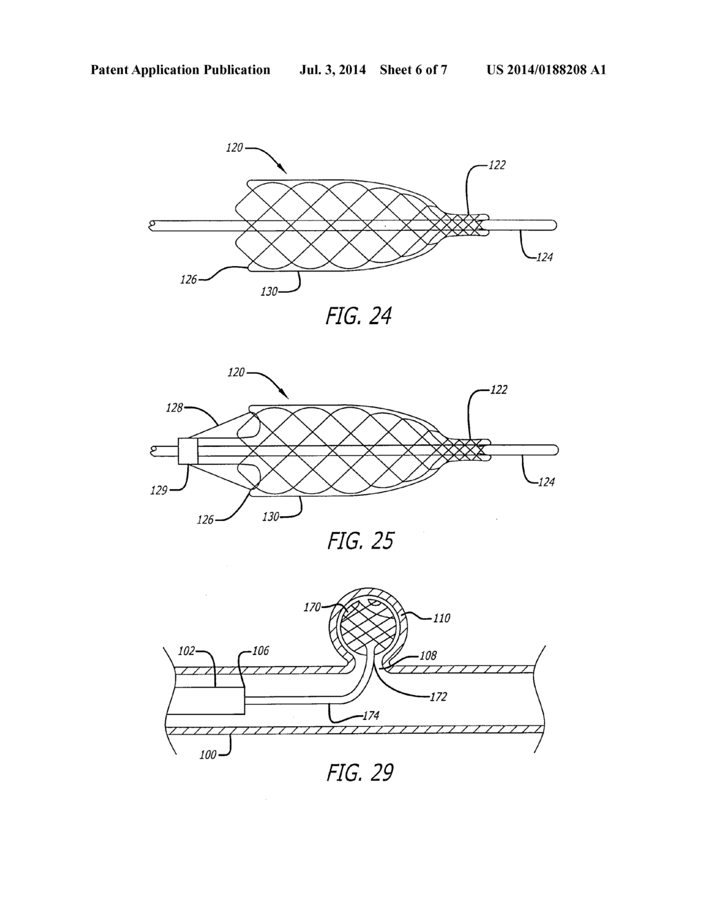 SELF-EXPANDING PSEUDO-BRAIDED INTRAVASCULAR DEVICE - diagram, schematic, and image 07