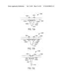 METHOD AND APPARATUS FOR CATHETER-BASED ANNULOPLASTY USING LOCAL     PLICATIONS diagram and image