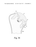 IMPLANT INSERTION TOOL FOR USE IN A SURGICAL PROCEDURE TO IMPLANT A     STEMLESS HUMERAL COMPONENT diagram and image