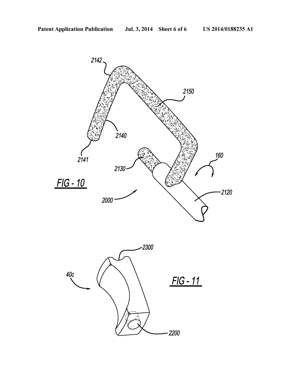 PROSTHETIC SYSTEM - diagram, schematic, and image 07