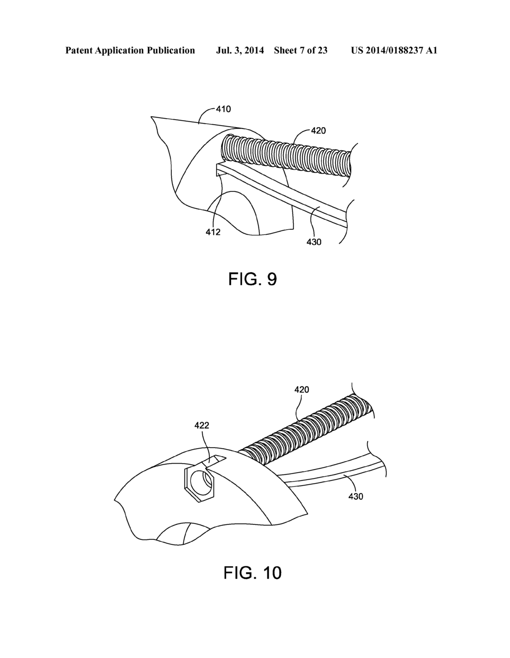 DEVICE AND METHOD FOR FIXATION FOR BONE OR SOFT TISSUE DEFORMITY OF DIGITS - diagram, schematic, and image 08