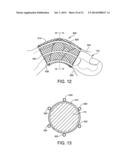 DEVICE AND METHOD FOR FIXATION FOR BONE OR SOFT TISSUE DEFORMITY OF DIGITS diagram and image