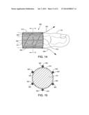 DEVICE AND METHOD FOR FIXATION FOR BONE OR SOFT TISSUE DEFORMITY OF DIGITS diagram and image