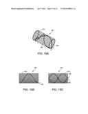 DEVICE AND METHOD FOR FIXATION FOR BONE OR SOFT TISSUE DEFORMITY OF DIGITS diagram and image