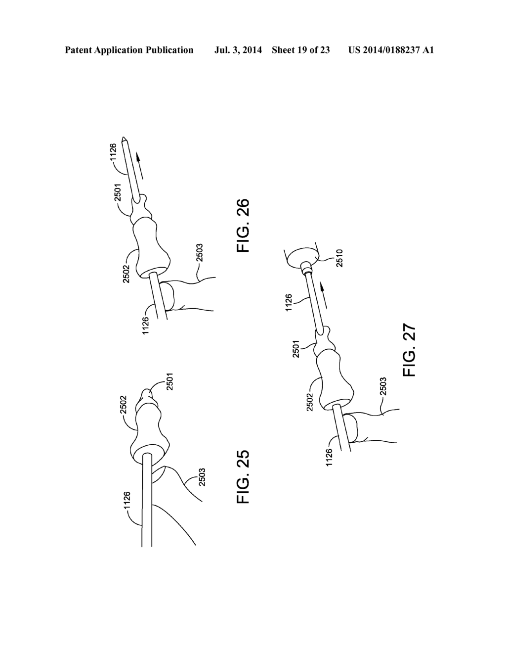 DEVICE AND METHOD FOR FIXATION FOR BONE OR SOFT TISSUE DEFORMITY OF DIGITS - diagram, schematic, and image 20