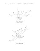 BALL AND SOCKET IMPLANTS FOR CORRECTION OF HAMMER TOES AND CLAW TOES diagram and image