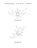 BALL AND SOCKET IMPLANTS FOR CORRECTION OF HAMMER TOES AND CLAW TOES diagram and image