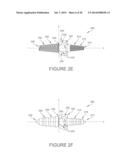 BALL AND SOCKET IMPLANTS FOR CORRECTION OF HAMMER TOES AND CLAW TOES diagram and image