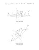 BALL AND SOCKET IMPLANTS FOR CORRECTION OF HAMMER TOES AND CLAW TOES diagram and image