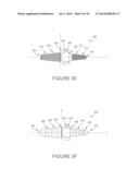 BALL AND SOCKET IMPLANTS FOR CORRECTION OF HAMMER TOES AND CLAW TOES diagram and image