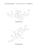 BALL AND SOCKET IMPLANTS FOR CORRECTION OF HAMMER TOES AND CLAW TOES diagram and image