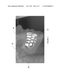 ORTHODONTIC TREATMENT PLANNING USING VIRTUAL ARTICULATOR diagram and image