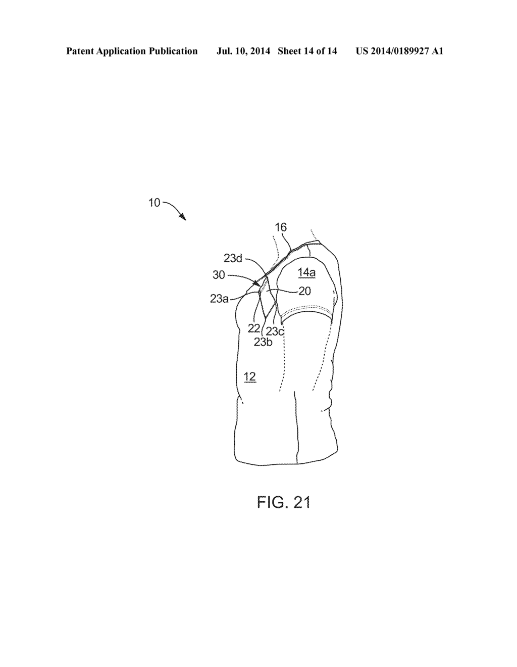 UNIVERSALLY-DIRECTED, CLOSURE-SUPPORTED, GRAVITY-CATCH, SELF-ENERGIZING,     DIAGONAL POCKET APPARATUS AND METHOD - diagram, schematic, and image 15