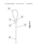 RELEASABLE AND EXTENDABLE ZIPPER ATTACHMENT diagram and image