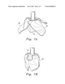 PORTABLE ALARM SYSTEM FOR COFFINS diagram and image