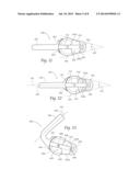 Rotary Cutter diagram and image