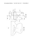 Detachable Clamping Sinker With Water Soluble Detachment diagram and image