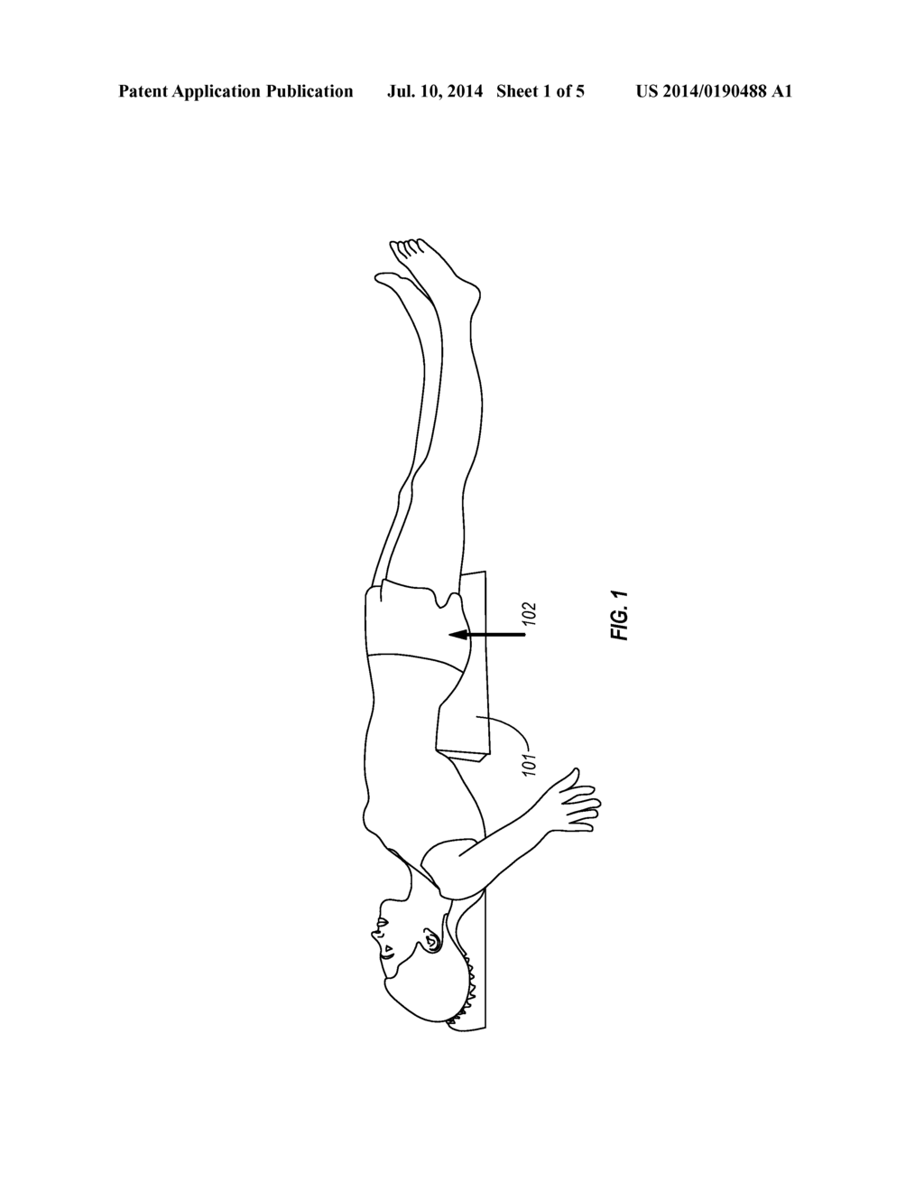 DEVICE AND METHOD FOR PELVIC ELEVATION AND STABILIZATION OF SURGICAL     PATIENT - diagram, schematic, and image 02