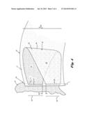 VEHICLE SEAT ASSEMBLY WITH SIDE AIR BAG AND GUIDE PANEL WITH SPACED     FORWARD ENDS FOR CREATING A SHEARING FORCE diagram and image