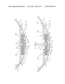 EXPANDABLE SEALING MECHANISM diagram and image