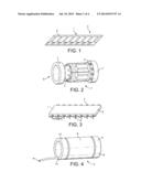 Radiofrequency Coils diagram and image