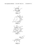 Radiofrequency Coils diagram and image