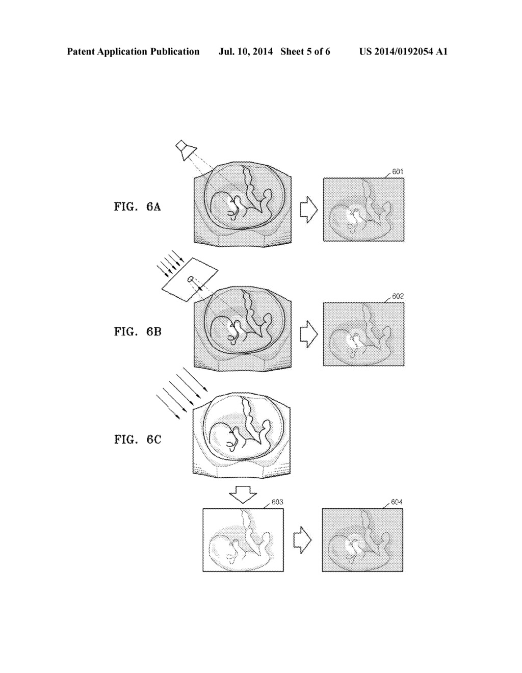 METHOD AND APPARATUS FOR PROVIDING MEDICAL IMAGES - diagram, schematic, and image 06