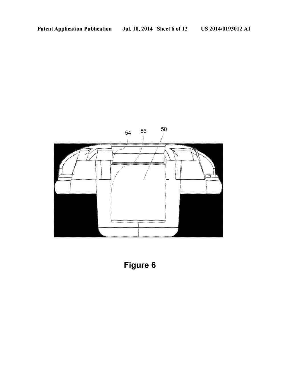 HEARING AID COMPONENT WITH EARWAX FILTER - diagram, schematic, and image 07