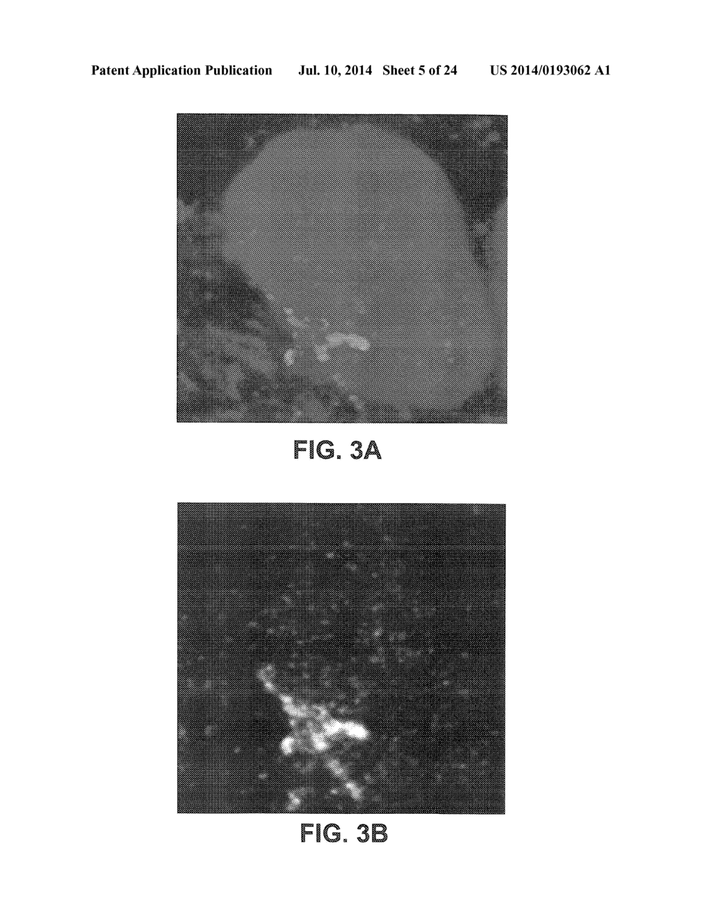 METHODS AND APPARATUS FOR DIAGNOSIS AND/OR PROGNOSIS OF CANCER - diagram, schematic, and image 06