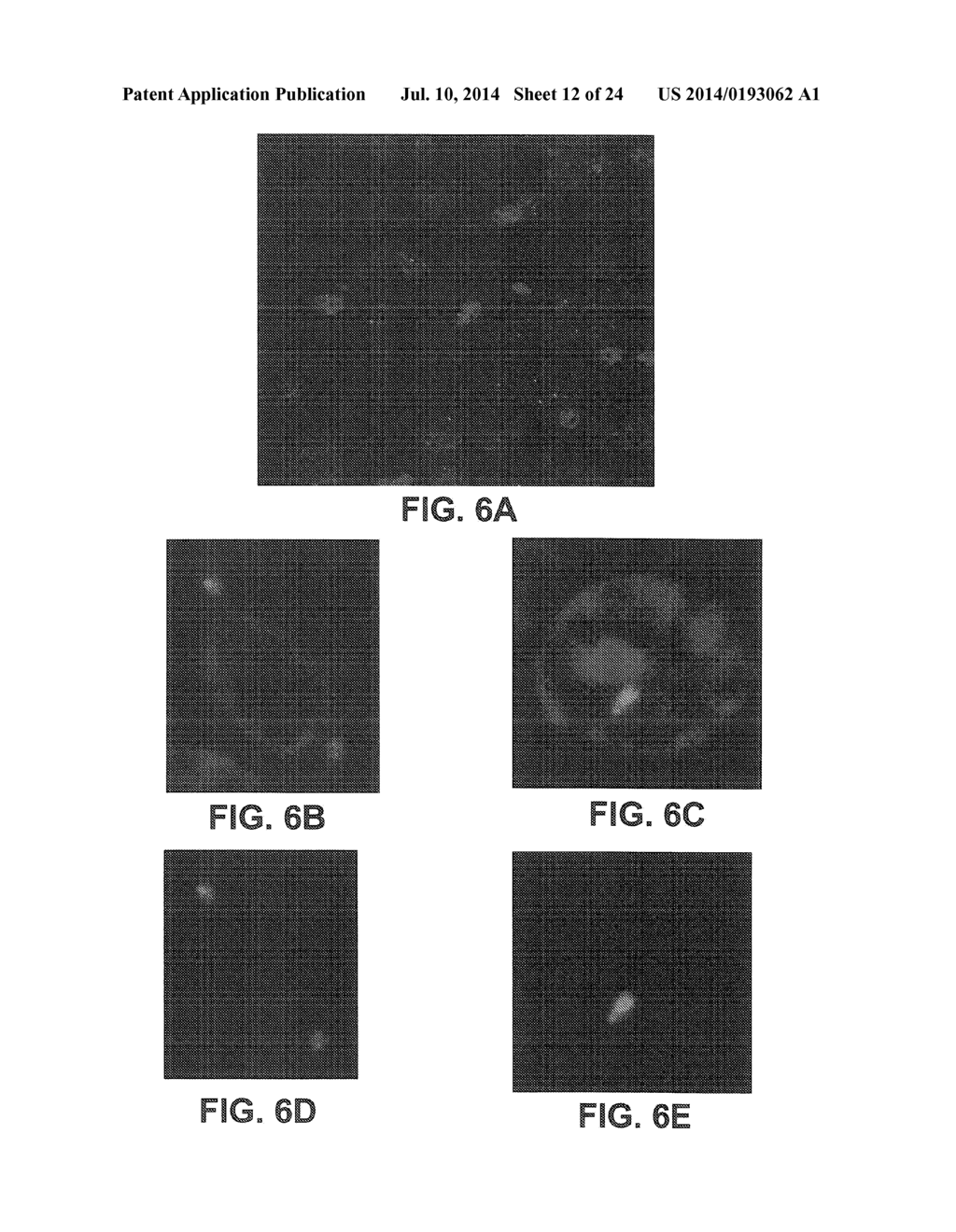 METHODS AND APPARATUS FOR DIAGNOSIS AND/OR PROGNOSIS OF CANCER - diagram, schematic, and image 13