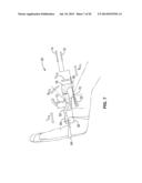 TREATMENT OF CARPAL TUNNEL SYNDROME BY INJECTION OF THE FLEXOR RETINACULUM diagram and image