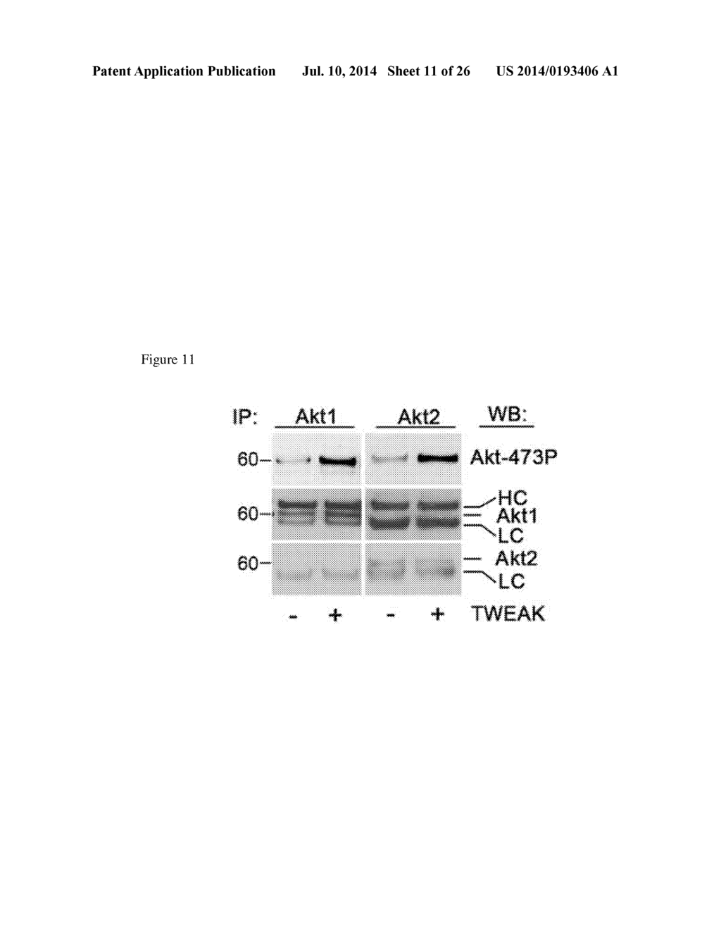 METHODS USED IN IDENTIFYING GLIOBLASTOMA - diagram, schematic, and image 12