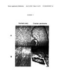 Membrane Transporter NaPi2b (SCL34A2) Epitope for Antibody Therapy,     Antibodies Directed Thereto, and Target for Cancer Therapy diagram and image