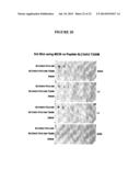 Membrane Transporter NaPi2b (SCL34A2) Epitope for Antibody Therapy,     Antibodies Directed Thereto, and Target for Cancer Therapy diagram and image