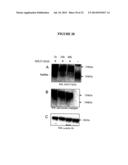 Membrane Transporter NaPi2b (SCL34A2) Epitope for Antibody Therapy,     Antibodies Directed Thereto, and Target for Cancer Therapy diagram and image