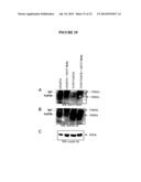 Membrane Transporter NaPi2b (SCL34A2) Epitope for Antibody Therapy,     Antibodies Directed Thereto, and Target for Cancer Therapy diagram and image