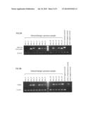 DIAGNOSIS AND TREATMENT OF CANCER USING ANTI-ITM2A ANTIBODY diagram and image