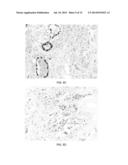 DIAGNOSIS AND TREATMENT OF VIRAL DISEASES diagram and image