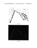 DIAGNOSIS AND TREATMENT OF VIRAL DISEASES diagram and image