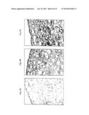 METHODS FOR PREPARATION OF NEO-CARTILAGE CONSTRUCTS diagram and image