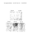 METHODS FOR PREPARATION OF NEO-CARTILAGE CONSTRUCTS diagram and image