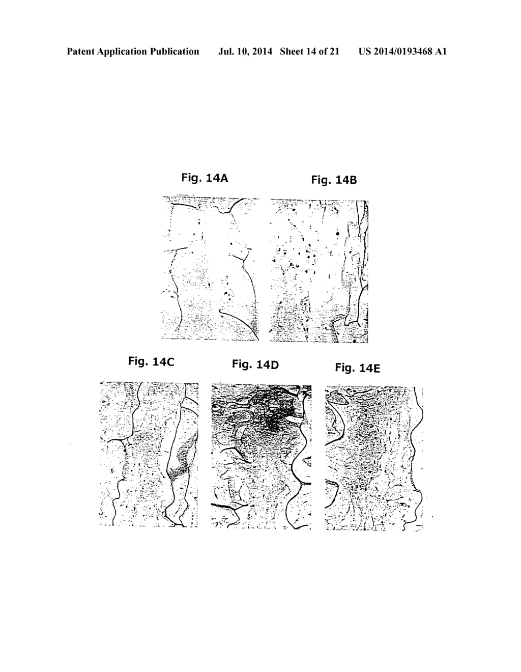 METHODS FOR PREPARATION OF NEO-CARTILAGE CONSTRUCTS - diagram, schematic, and image 15