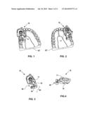 Dental Drill Platform with Adjustable Drill Bushing diagram and image