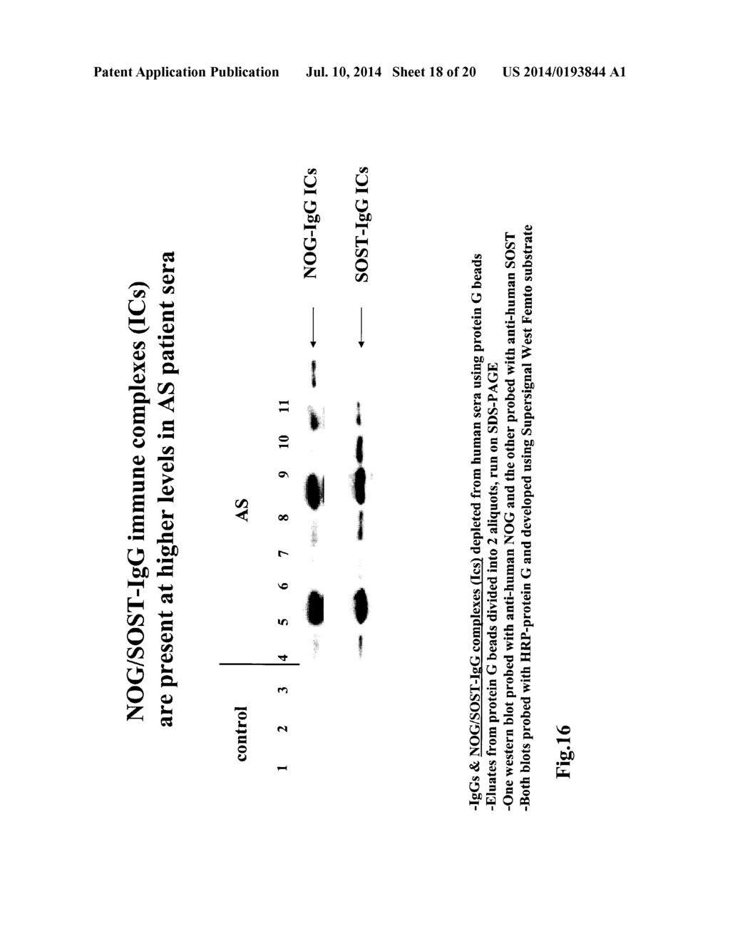 Biomarkers for Ankylosing Spondylitis - diagram, schematic, and image 19