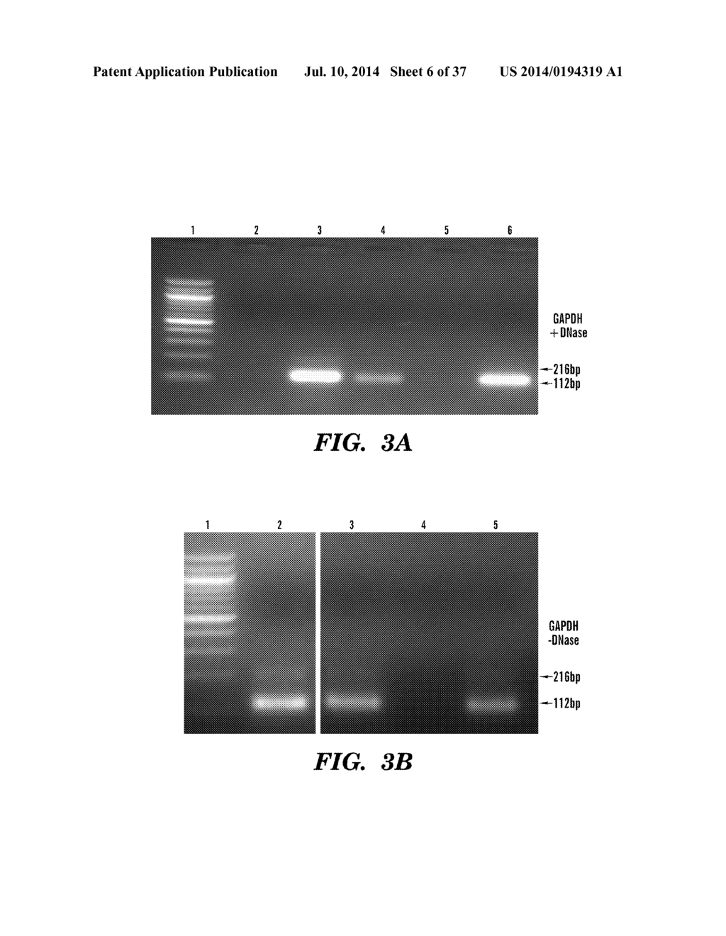 USE OF MICROVESICLES IN DIAGNOSIS AND PROGNOSIS OF MEDICAL DISEASES AND     CONDITIONS - diagram, schematic, and image 07