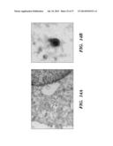 USE OF MICROVESICLES IN DIAGNOSIS AND PROGNOSIS OF MEDICAL DISEASES AND     CONDITIONS diagram and image