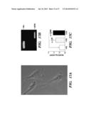 USE OF MICROVESICLES IN DIAGNOSIS AND PROGNOSIS OF MEDICAL DISEASES AND     CONDITIONS diagram and image