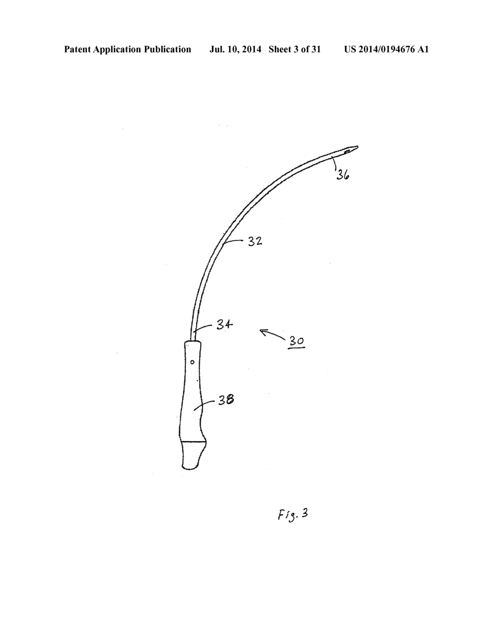 IMPLANTABLE DEVICES FOR THE TREATMENT OF INCONTINENCE AND METHODS OF USING     SAME - diagram, schematic, and image 04